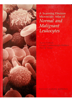 Normal and malignant leukocytes