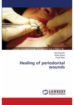 Healing of periodontal wounds