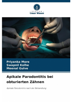 Apikale Parodontitis bei obturierten Zähnen