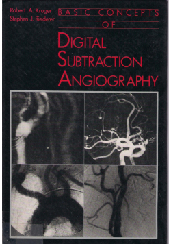 Basic concepts of Digital subtraction angiography