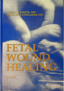 Fetal wound healing