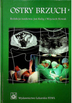 Ostry brzuch podręcznik dla lekarzy i studentów