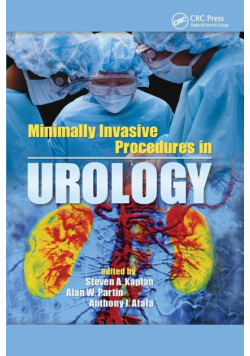 Minimally Invasive Procedures in Urology