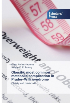 Obesity; most common metabolic complication in Prader-Willi syndrome