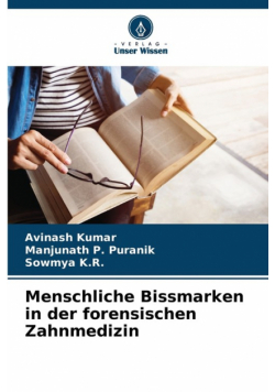 Menschliche Bissmarken in der forensischen Zahnmedizin