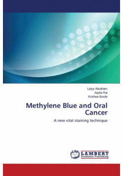 Methylene Blue and Oral Cancer