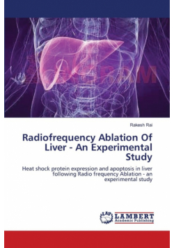 Radiofrequency Ablation Of Liver - An Experimental Study