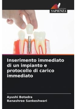 Inserimento immediato di un impianto e protocollo di carico immediato