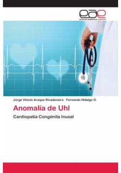 Anomalía de Uhl