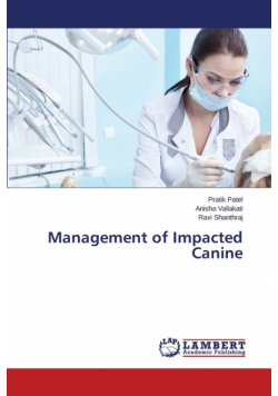 Management of Impacted Canine