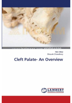 Cleft Palate- An Overview