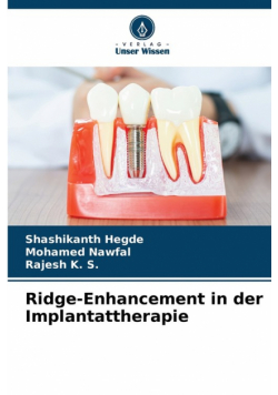Ridge-Enhancement in der Implantattherapie