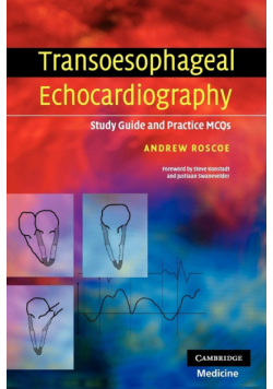 Transoesophageal Echocardiography