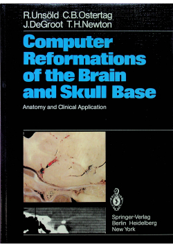 Computer Reformations of the Brain and Skull Base