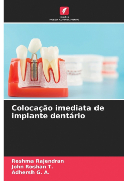 Colocação imediata de implante dentário