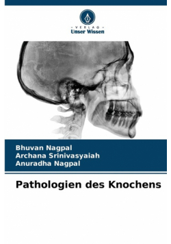 Pathologien des Knochens