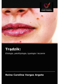 Trądzik