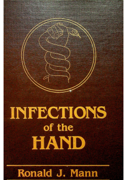 Infections of the hand