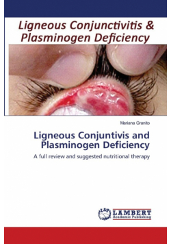 Ligneous Conjuntivis and Plasminogen Deficiency