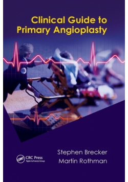 Clinical Guide to Primary Angioplasty