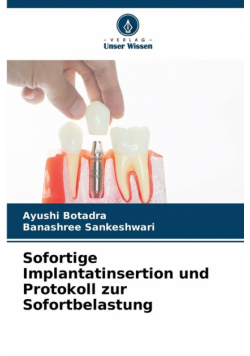 Sofortige Implantatinsertion und Protokoll zur Sofortbelastung