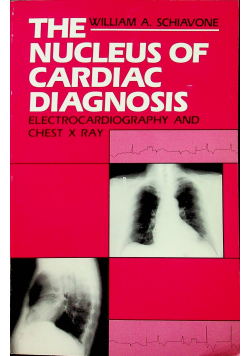 The nucleus of cardiac diagnosis