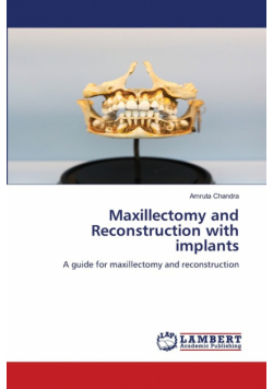 Maxillectomy and Reconstruction with implants