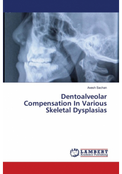 Dentoalveolar Compensation In Various Skeletal Dysplasias