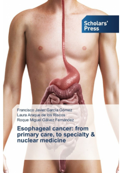 Esophageal cancer