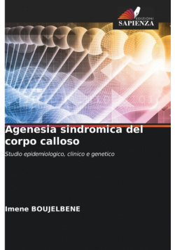 Agenesia sindromica del corpo calloso