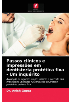Passos clínicos e impressões em dentisteria protética fixa - Um inquérito