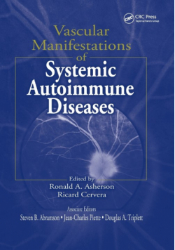 Vascular Manifestations of Systemic Autoimmune Diseases