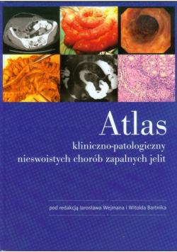 Atlas kliniczno-patologiczny nieswoistych chorób zapalnych jelit