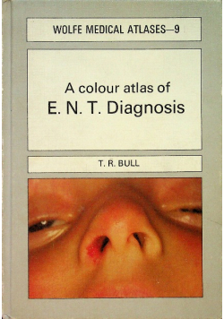 A Colour Atlas of E.N.T. Diagnosis