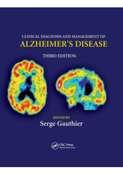 Clinical Diagnosis and Management of Alzheimer's Disease