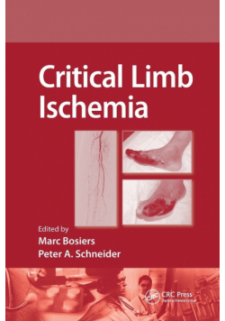 Critical Limb Ischemia