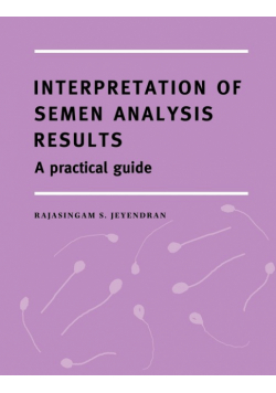 Interpretation of Semen Analysis Results