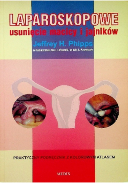 Laparoskopowe usunięcie macicy i jajników