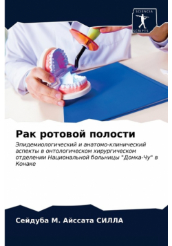 Рак ротовой полости