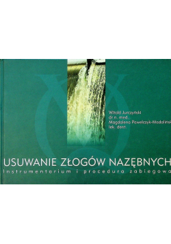 Usuwanie złogów nazębnych