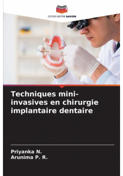 Techniques mini-invasives en chirurgie implantaire dentaire