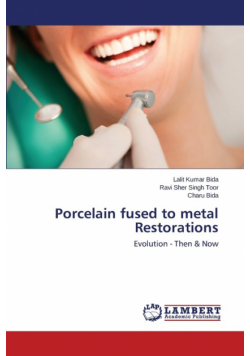Porcelain fused to metal Restorations