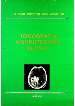 Tomografia komputerowa głowy
