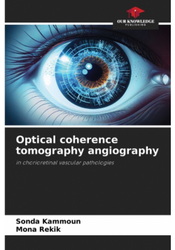 Optical coherence tomography angiography