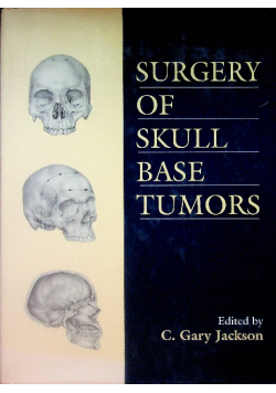 Surgery of Skull Base Tumors 1st Edition