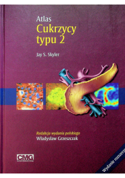 Atlas cukrzycy typu 2
