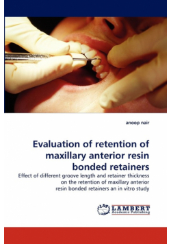 Evaluation of Retention of Maxillary Anterior Resin Bonded Retainers