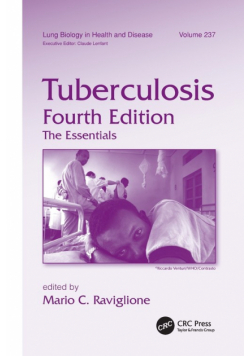Tuberculosis