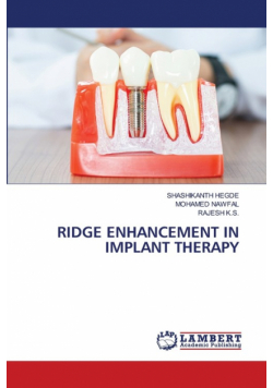 Ridge Enhancement In Implant Therapy