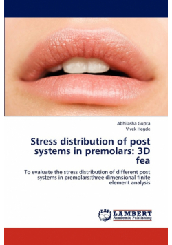 Stress distribution of post systems in premolars